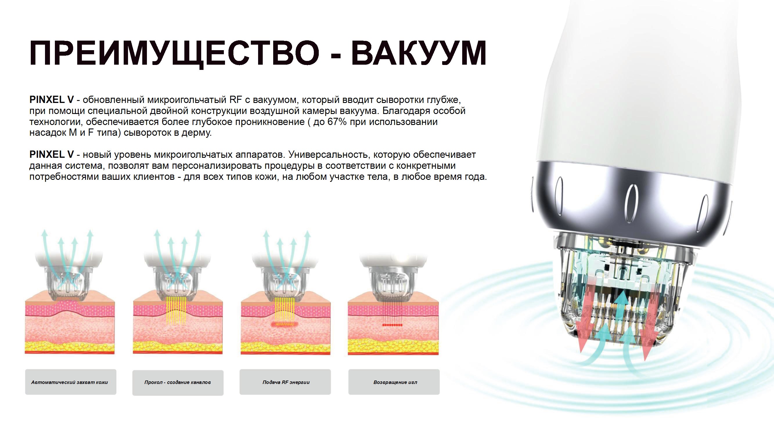 Преимущества вакуумной технологии